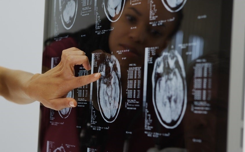 patient care for stroke